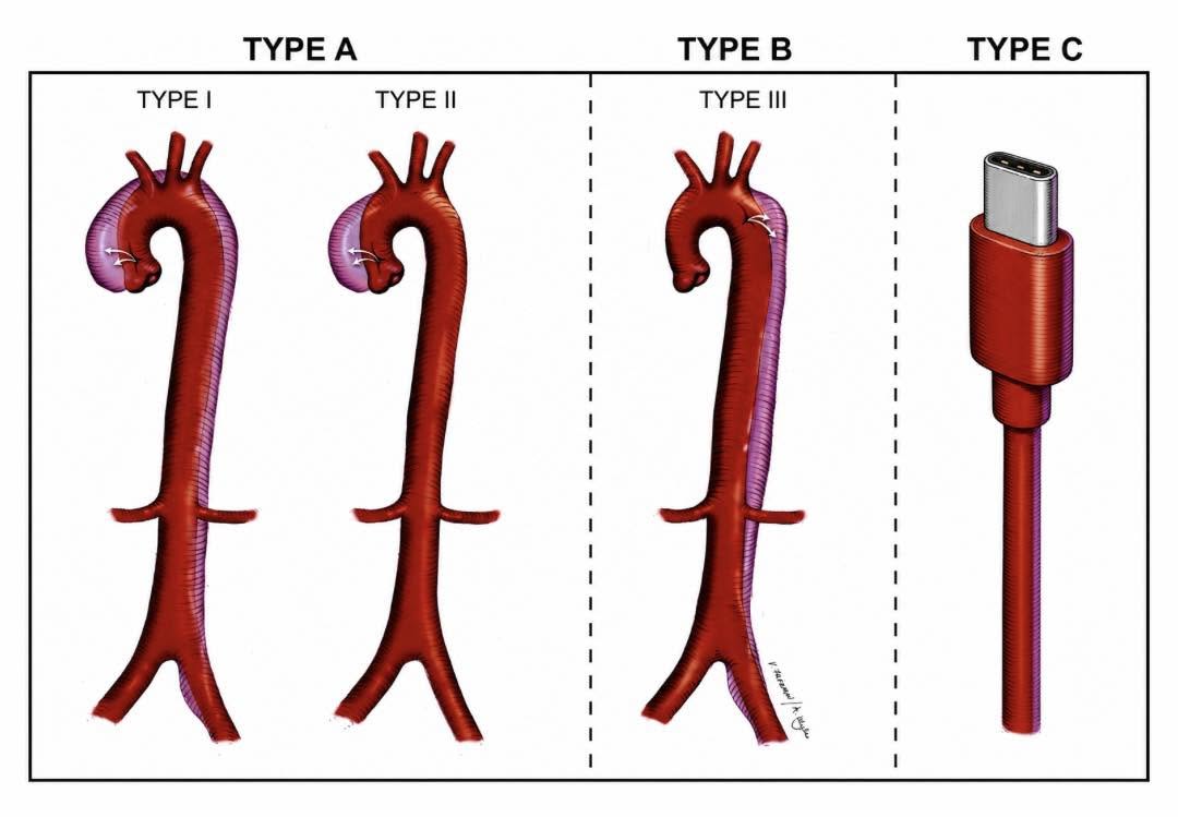 Type C